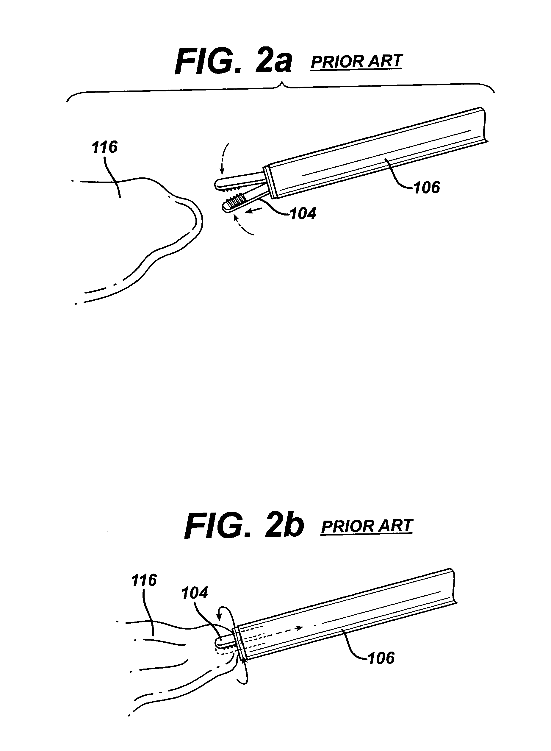 Bipolar tissue morcellator