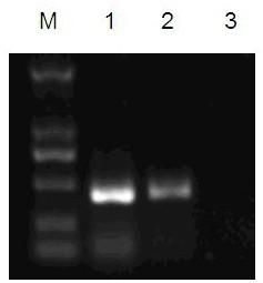 A degenerate primer RT-PCR detection method for Eimeria virus