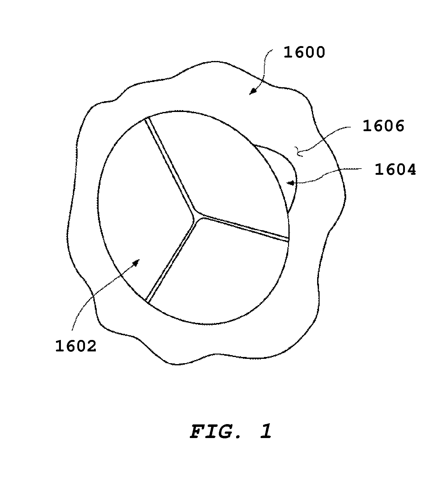 Devices for treating paravalvular leakage and methods use thereof