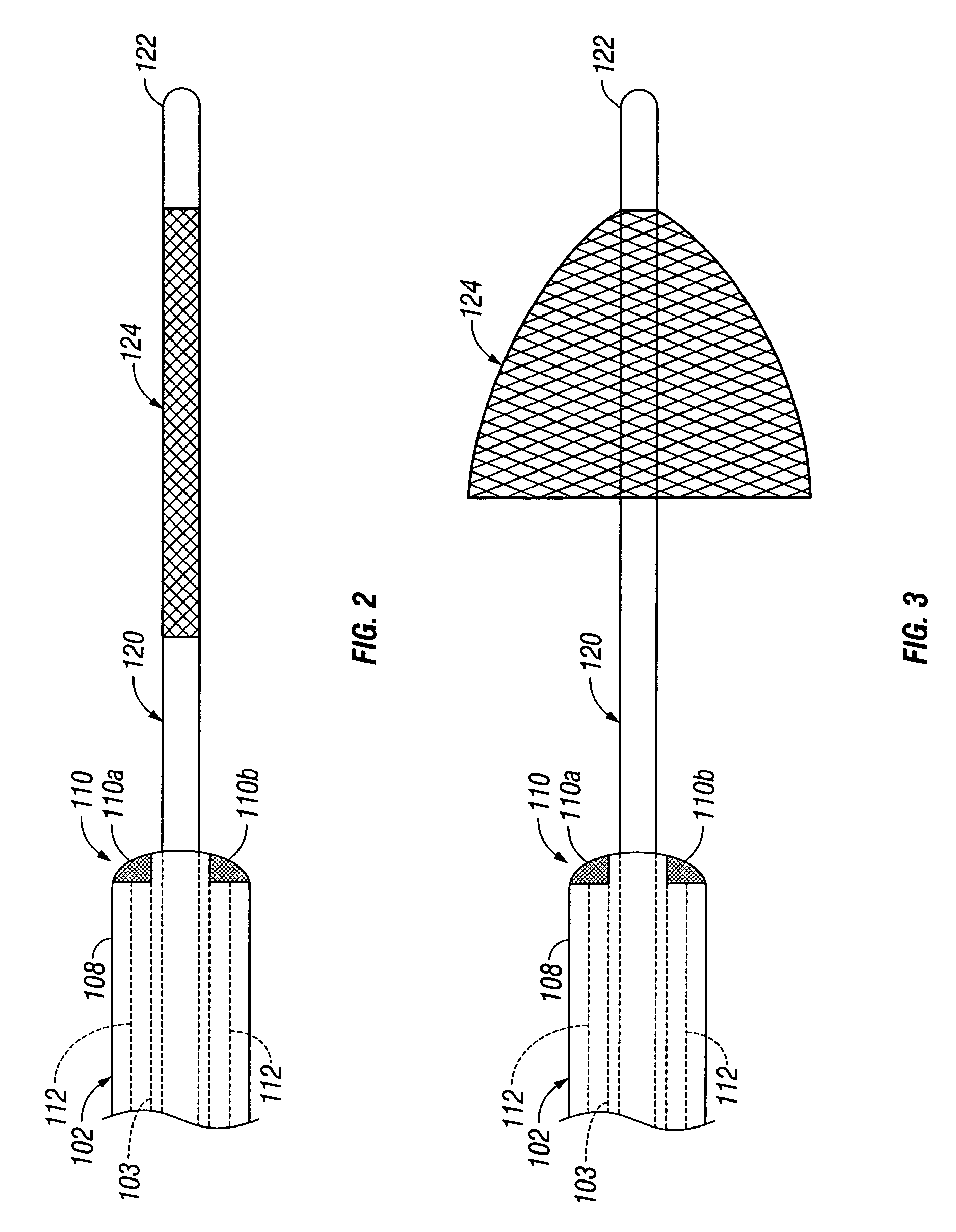 Percutaneous or surgical radiofrequency intravascular thrombectomy catheter system and method