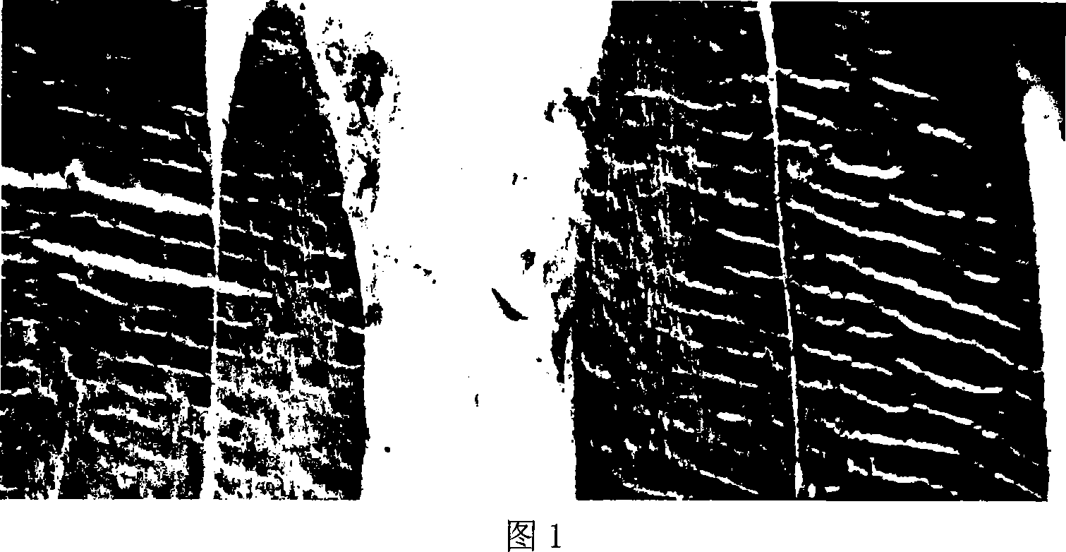 Section staining method for striped skeletal muscles