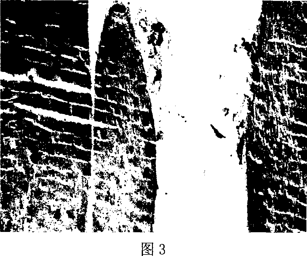 Section staining method for striped skeletal muscles