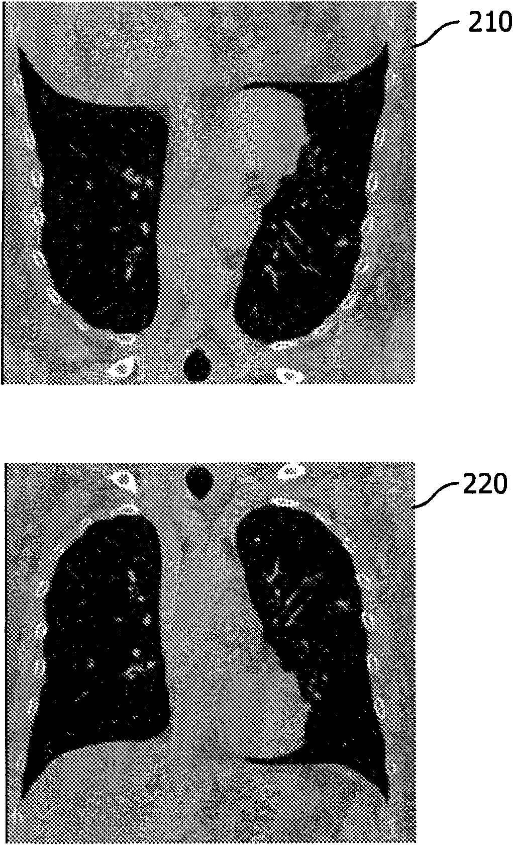 Method of automatically correcting mis-orientation of medical images