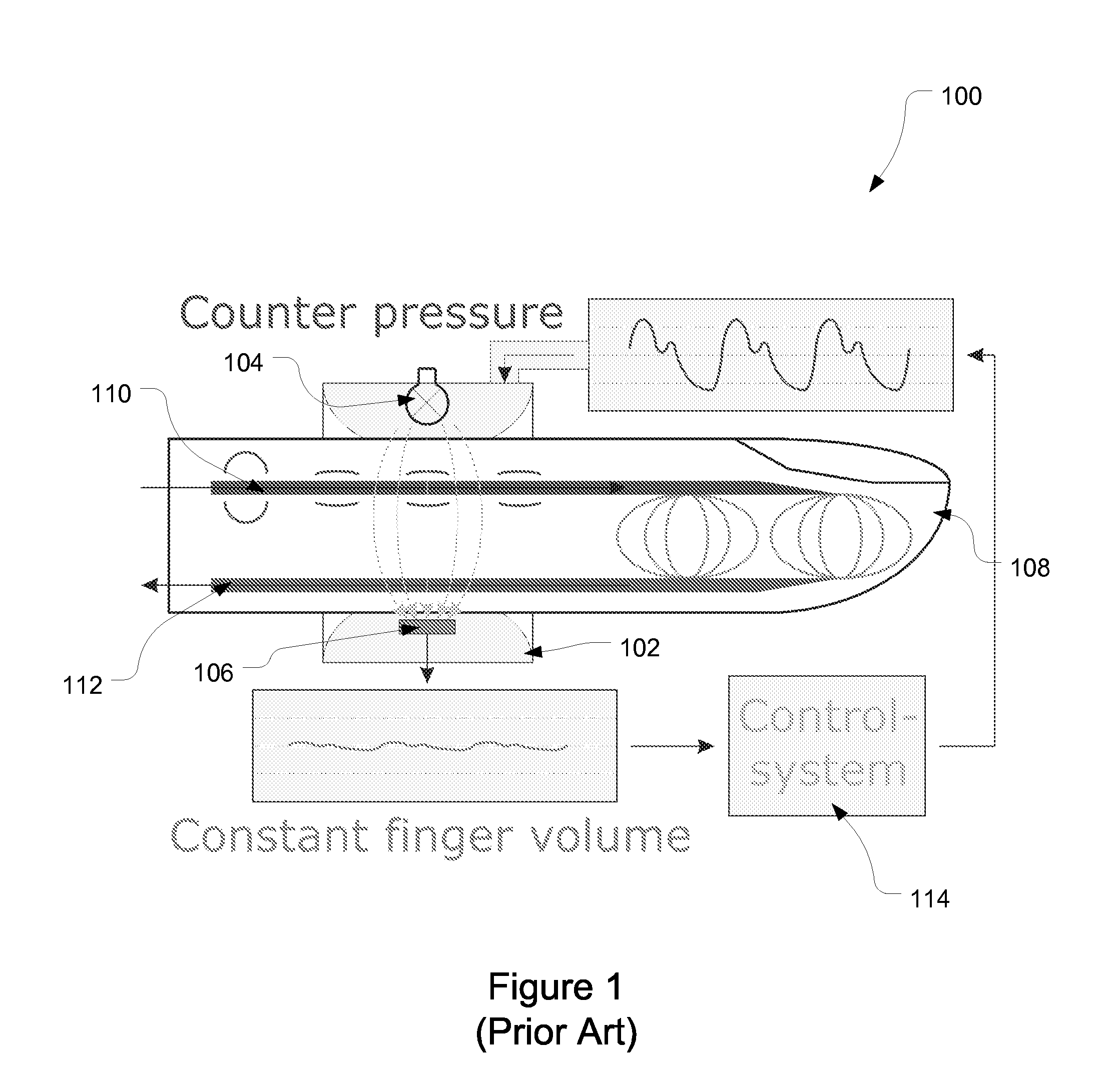 Apparatus and method for enhancing and analyzing signals from a continuous non-invasive blood pressure device