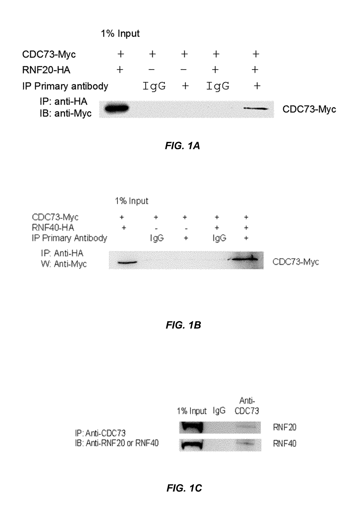 Histone protein ubiquitination as a cancer biomarker