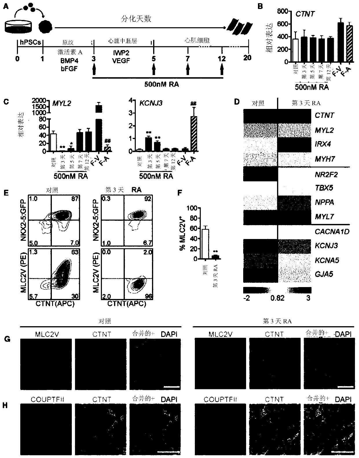 Generating atrial and ventricular cardiomyocyte lineages from human pluripotent stem cells