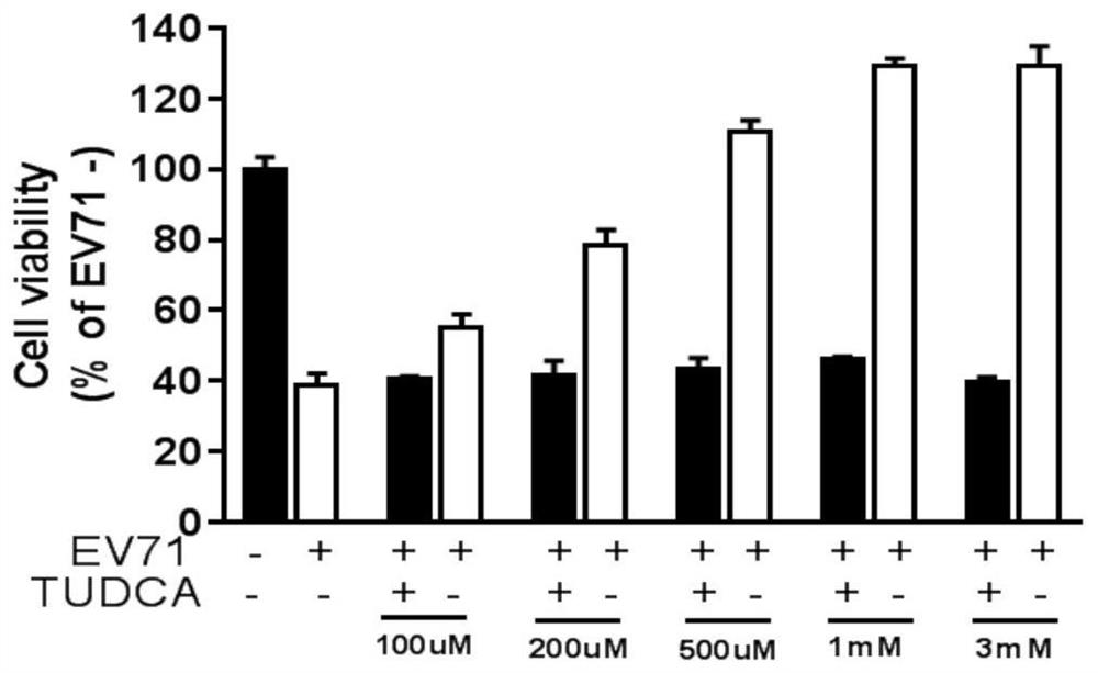 Application of tauroursodeoxycholic acid in anti-hand-foot-mouth virus and vesicular stomatitis virus drugs