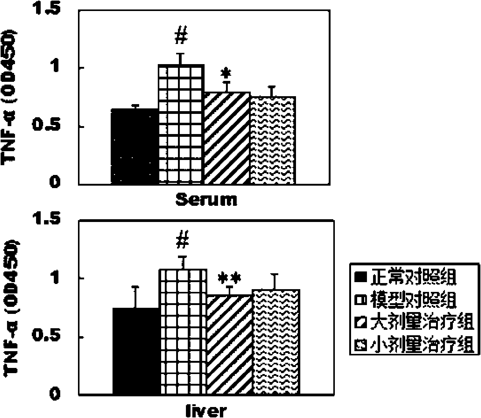 Use of IL-4 in preparing medicine for curing serious hepatitis