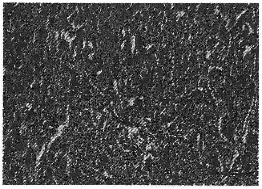 A method for improving calcification of artificial biological valve by means of coating