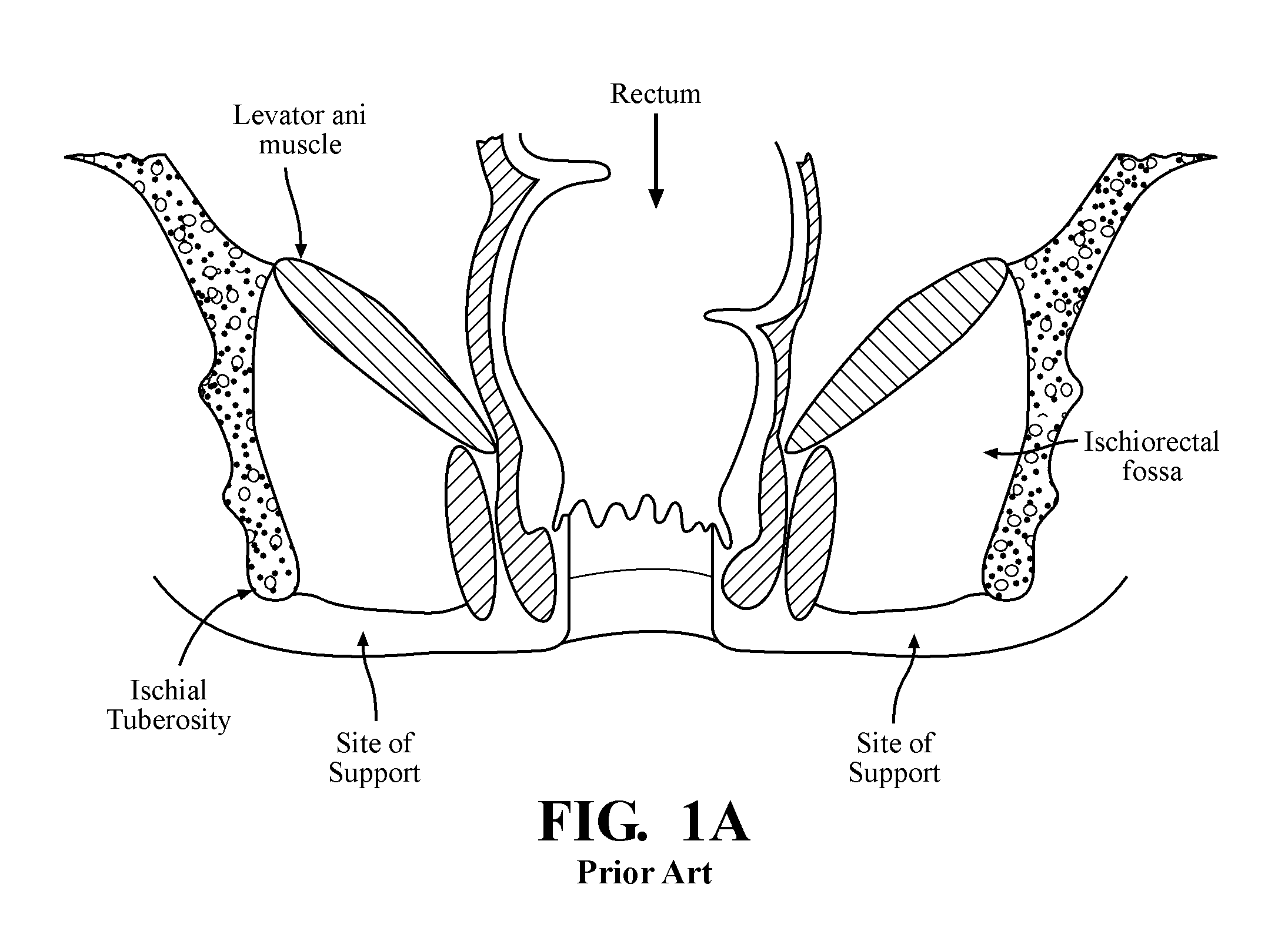 Toilet seat with anococcygeal support