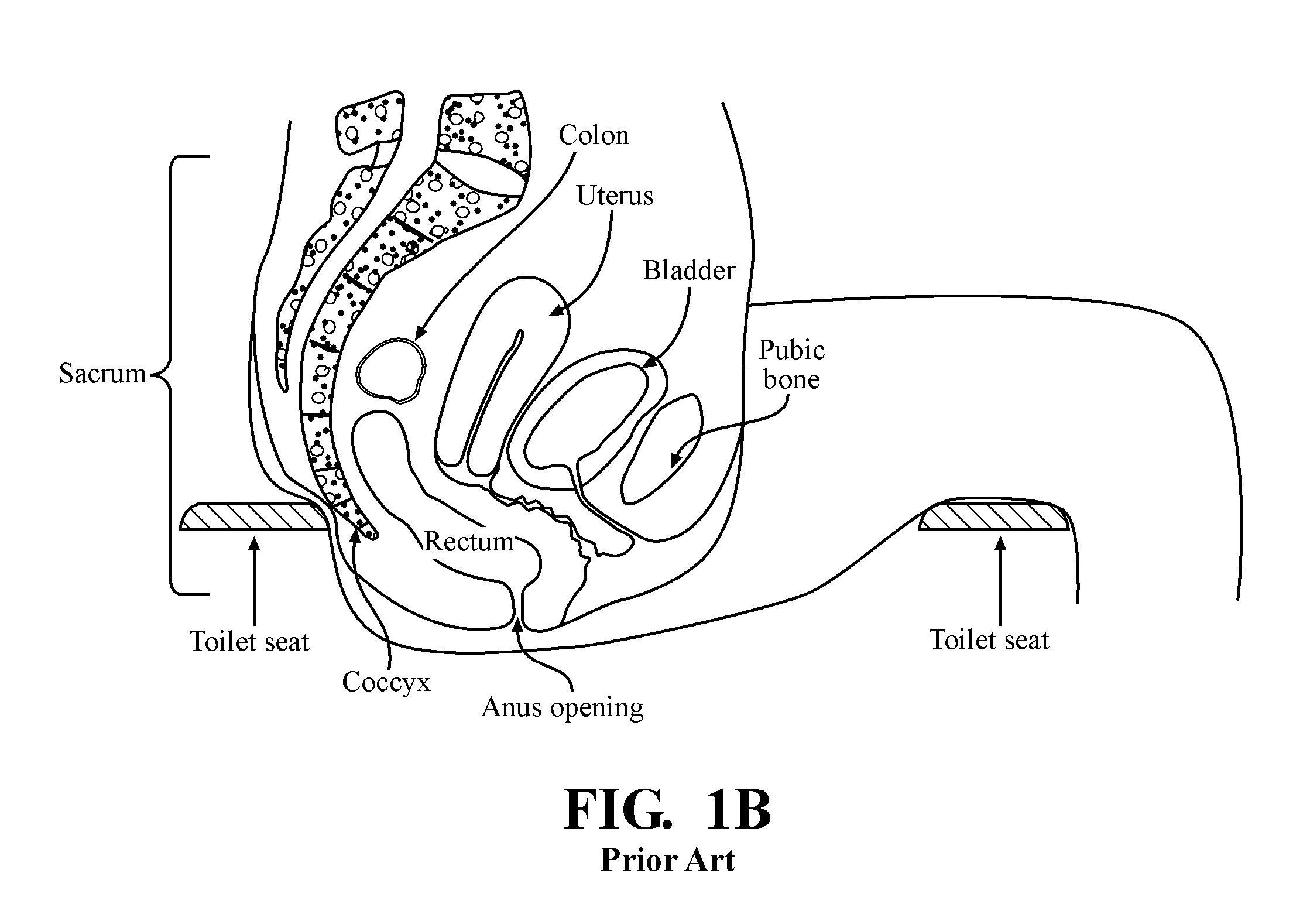 Toilet seat with anococcygeal support