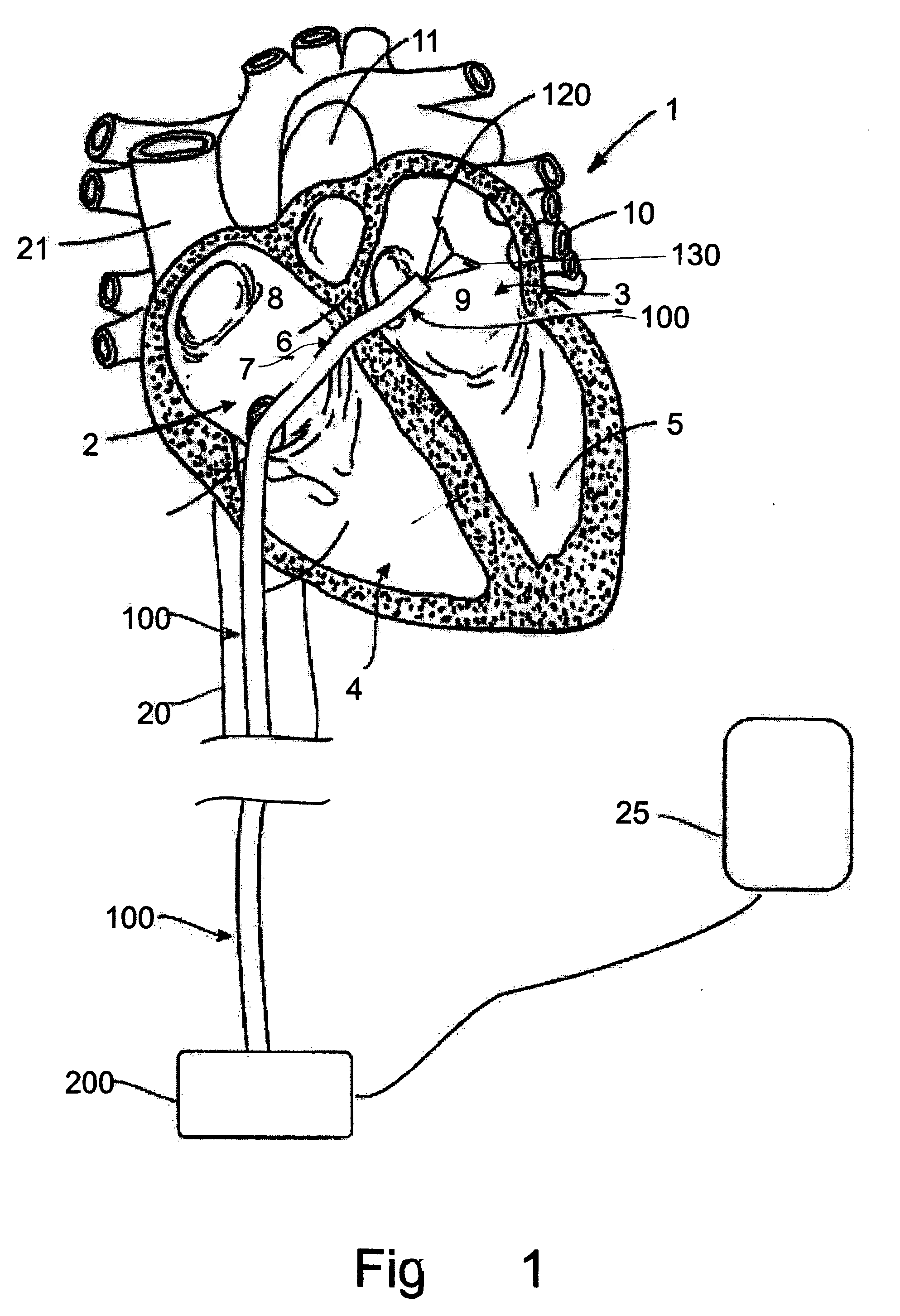 User interface for tissue ablation system
