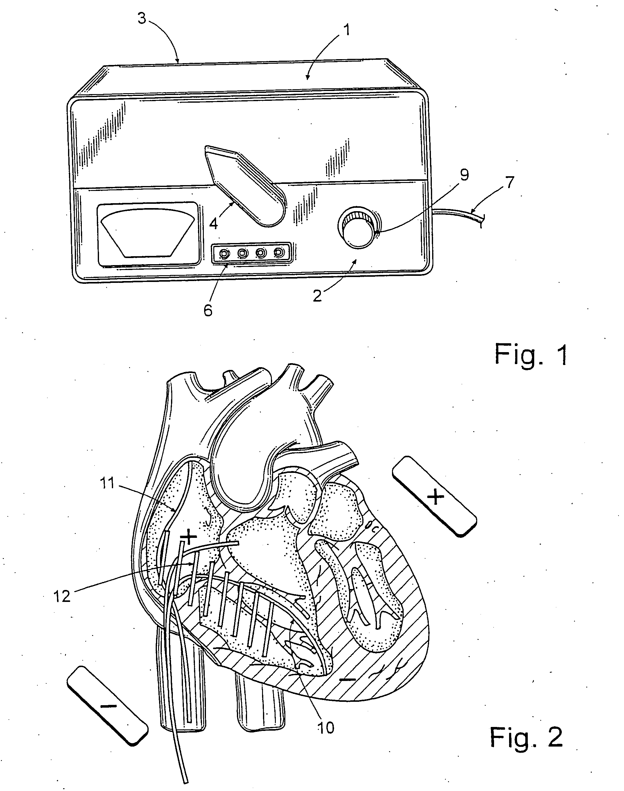 Apparatus and method for cardioversion