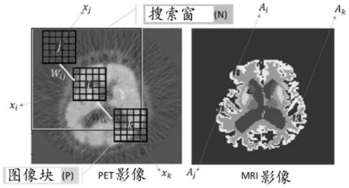 MR structure information constrained non-local mean value guided PET image partial volume correction method