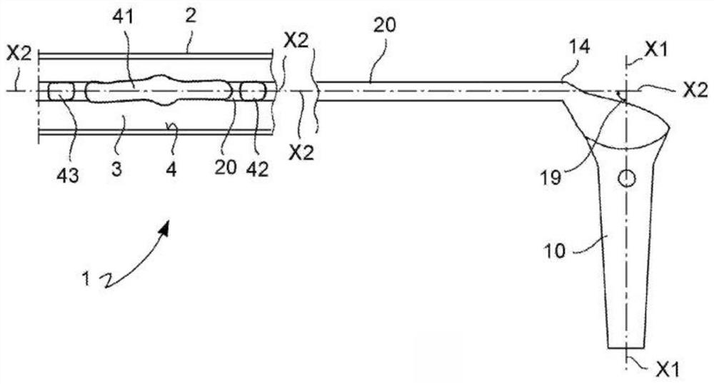 Vascular catheter and method