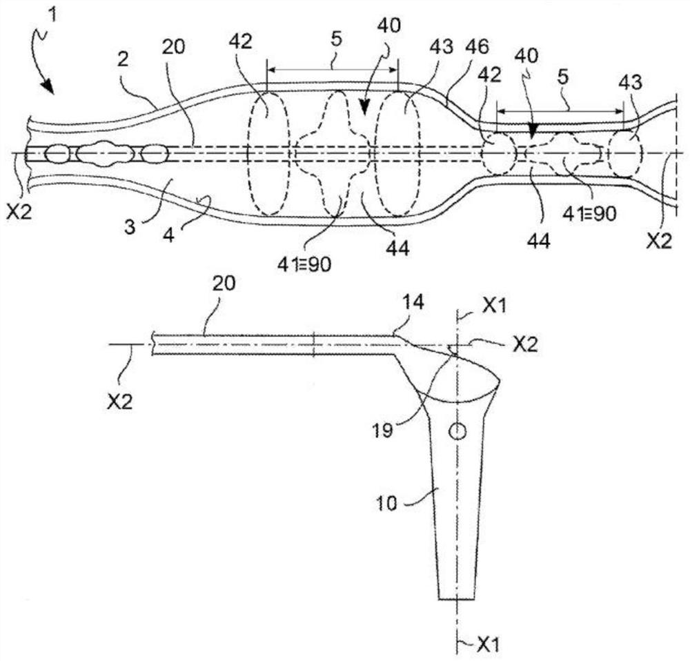 Vascular catheter and method