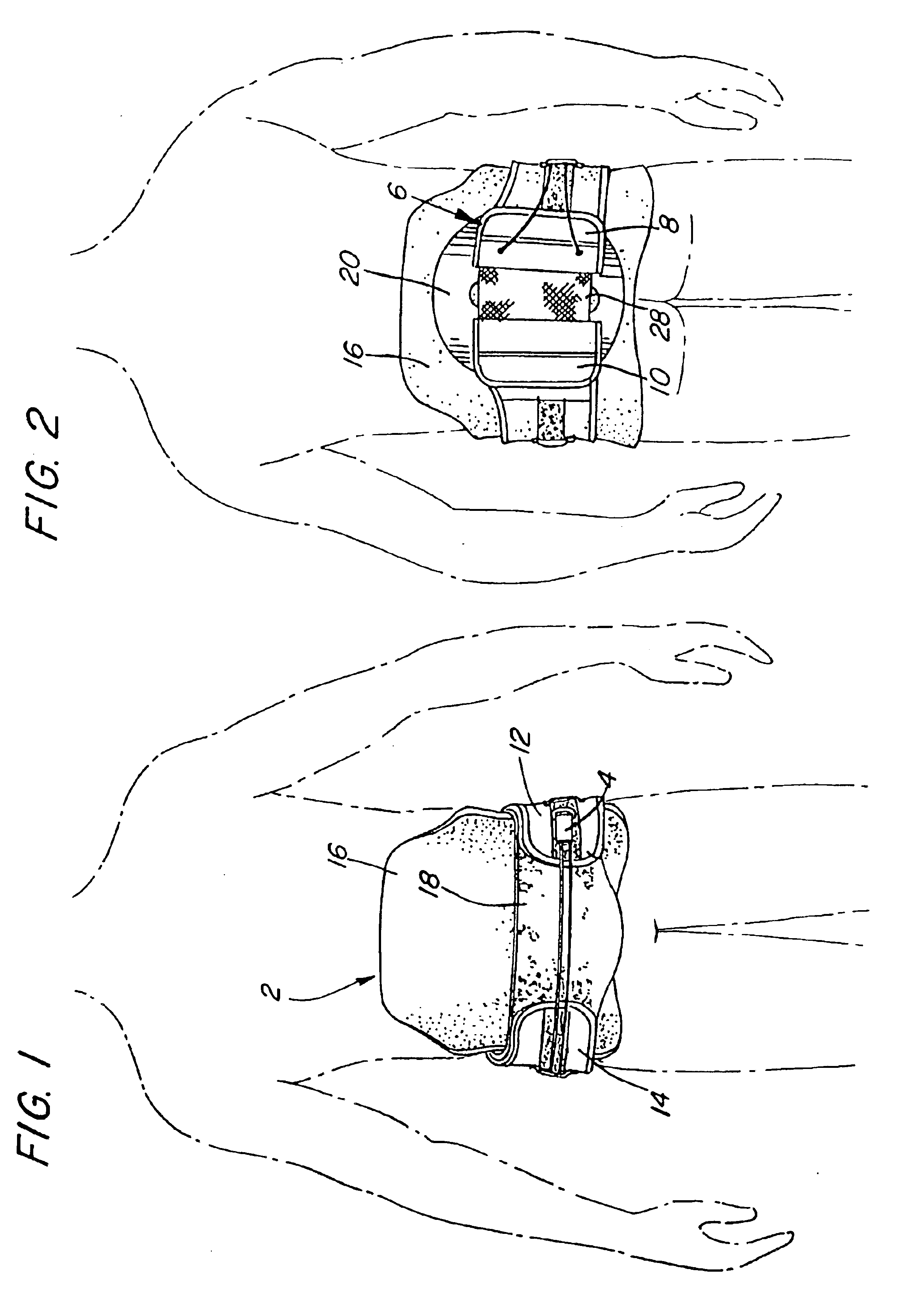 Modular orthosis closure system and method