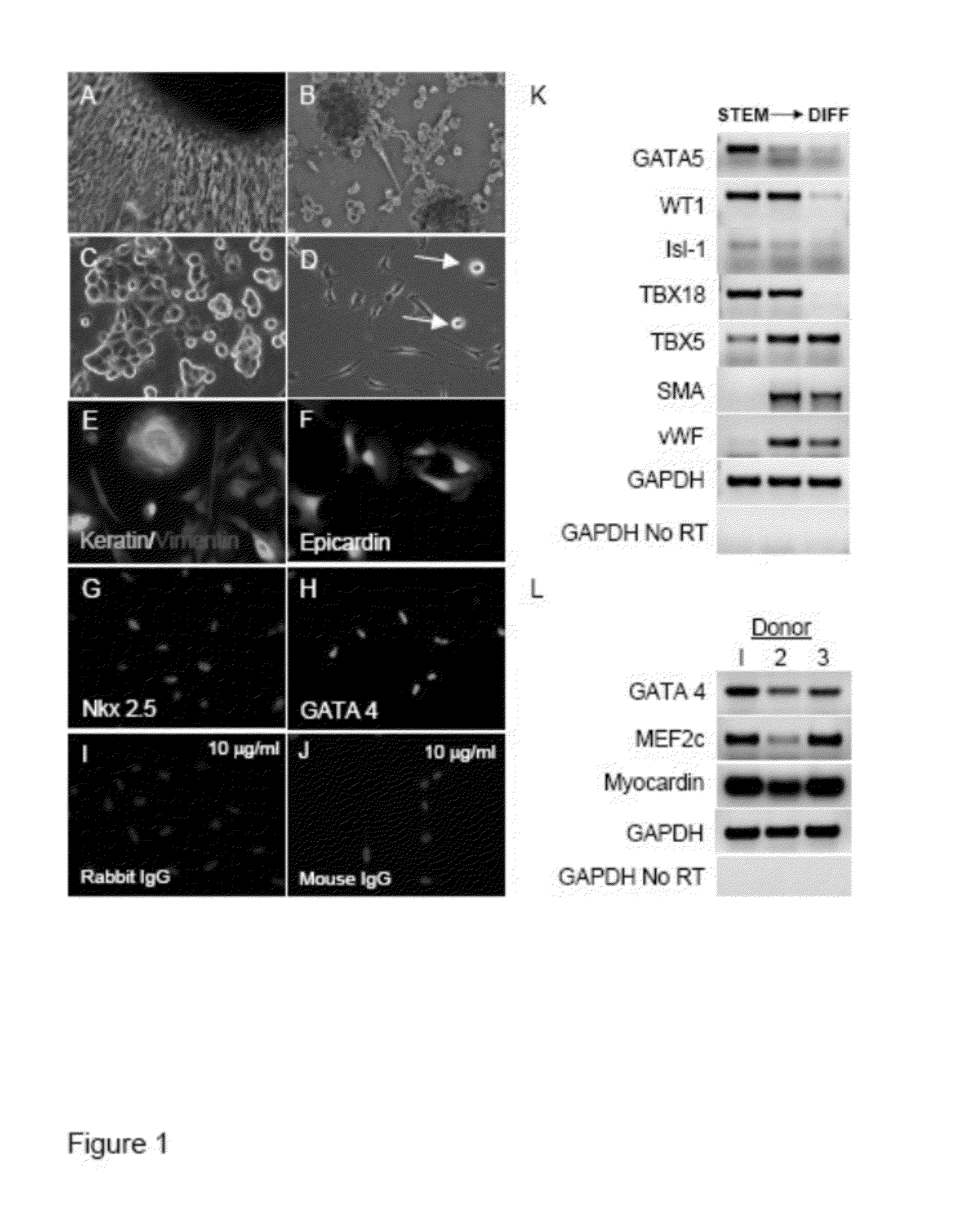 Compositions and methods for cardiac tissue repair