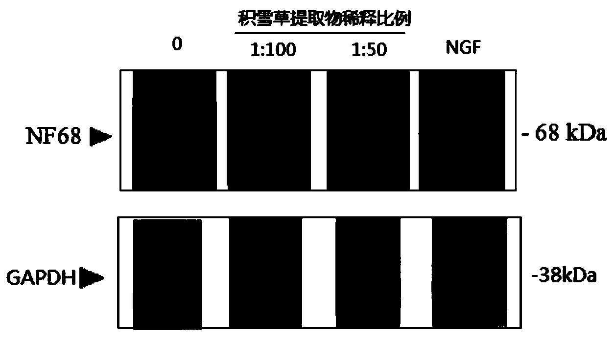 Centella extract as well as preparation and application thereof