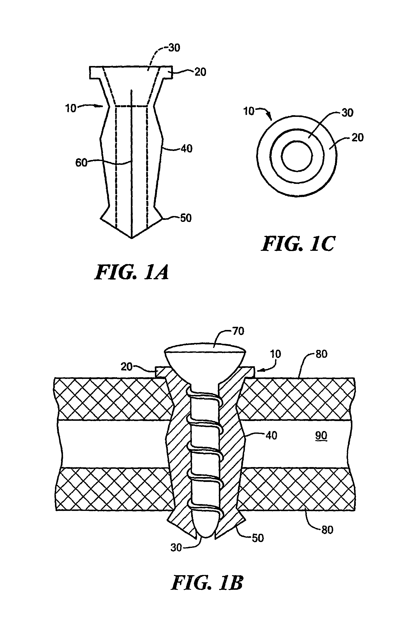 Apparatus for securing an implantable object to bone