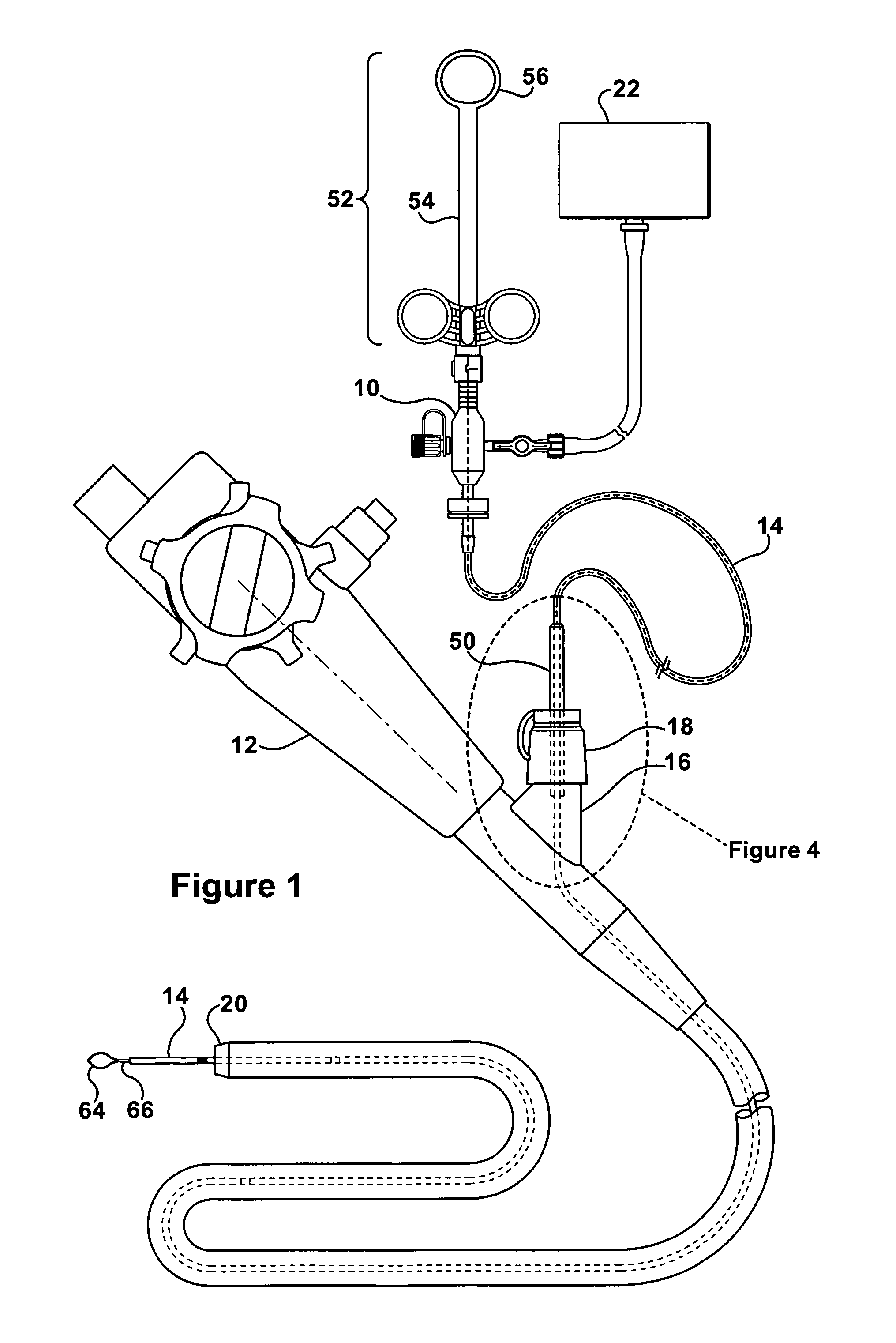 Polypectomy device and method of use