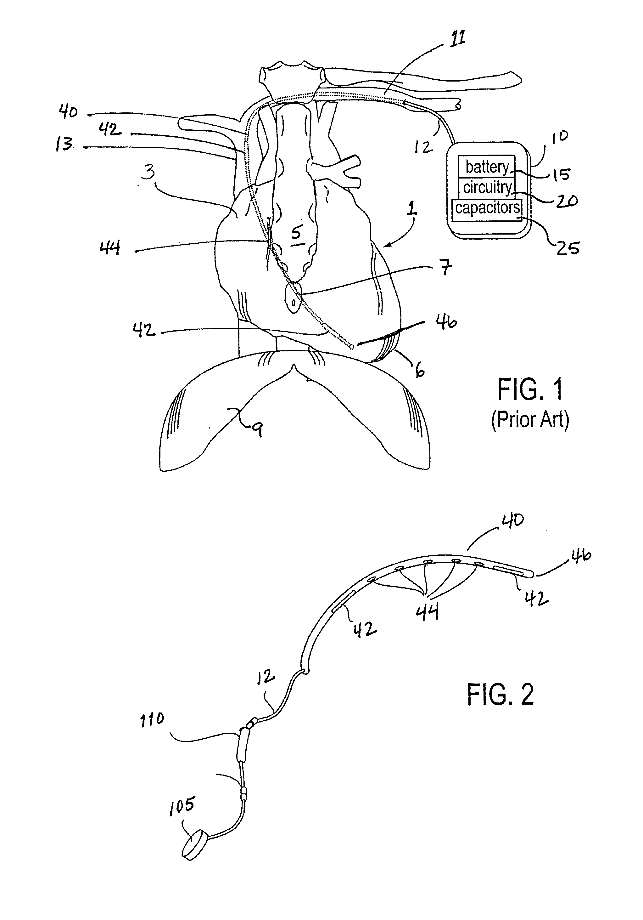 Implanted cardiac device for defibrillation