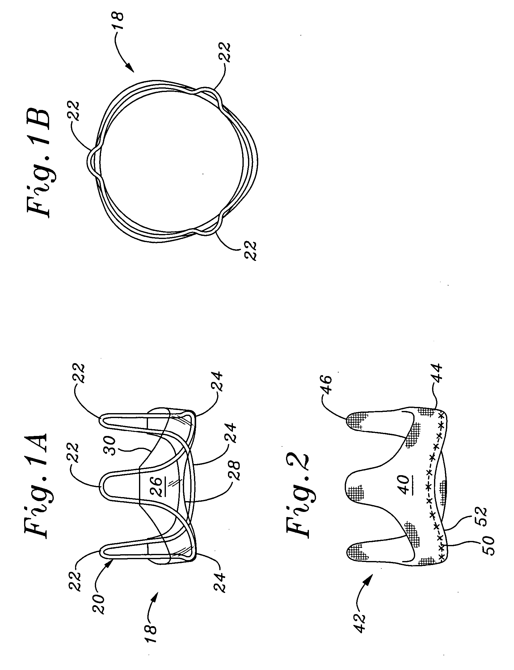 Systems and methods for assembling components of a fabric-covered prosthetic heart valve