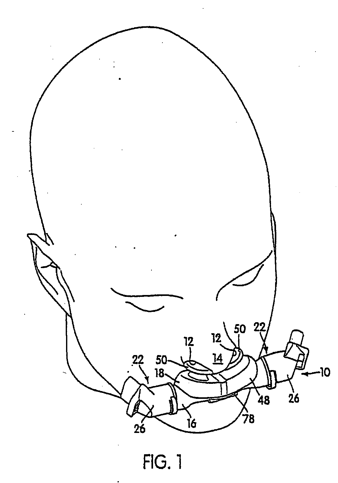 Nasal assembly