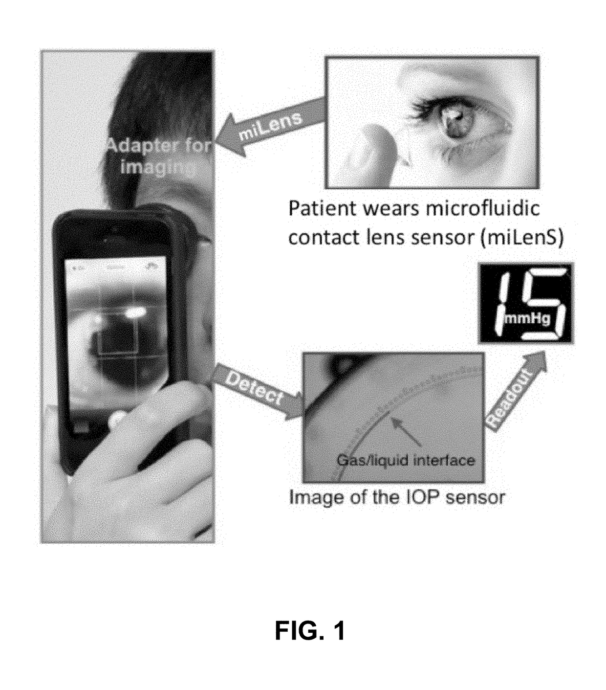 Closed Microfluidic Network for Strain Sensing Embedded in a Contact Lens to Monitor IntraOcular Pressure