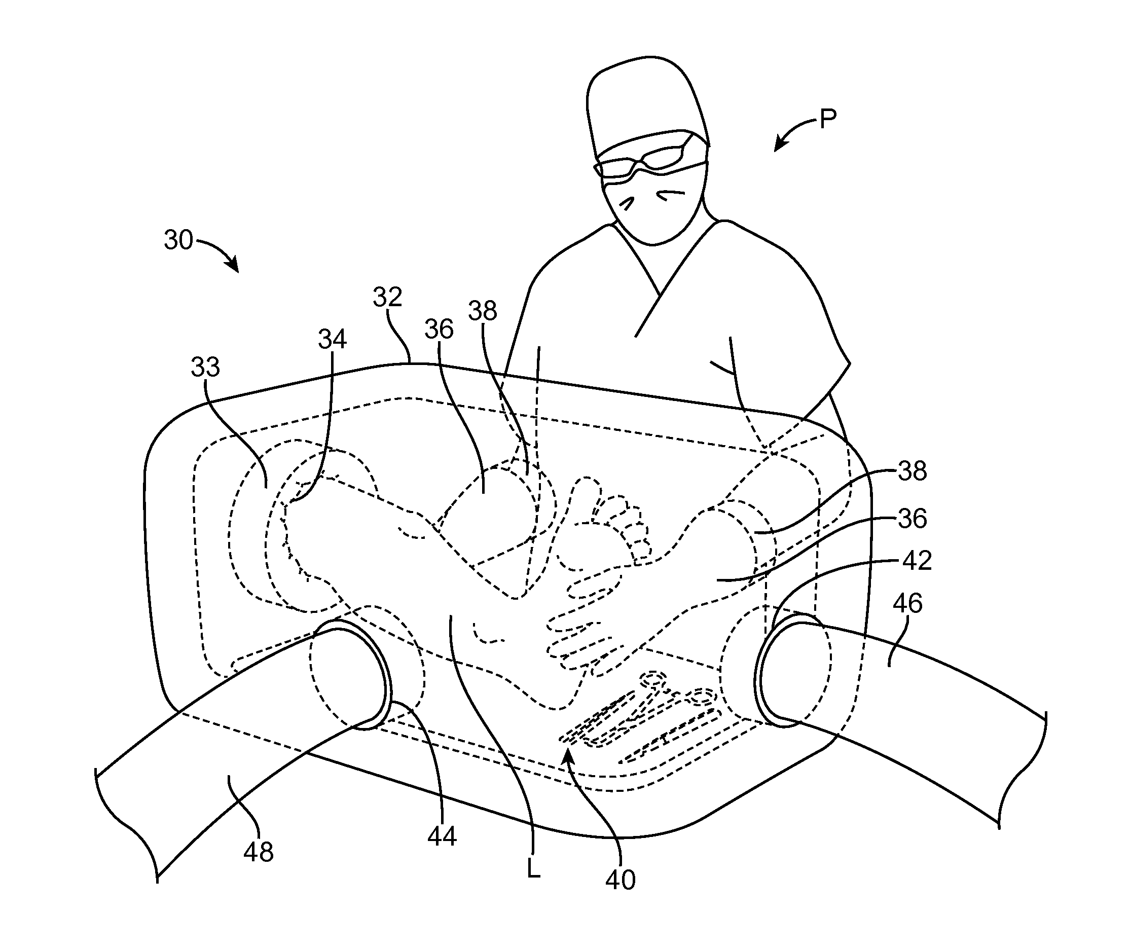 System and method for performing surgical procedures