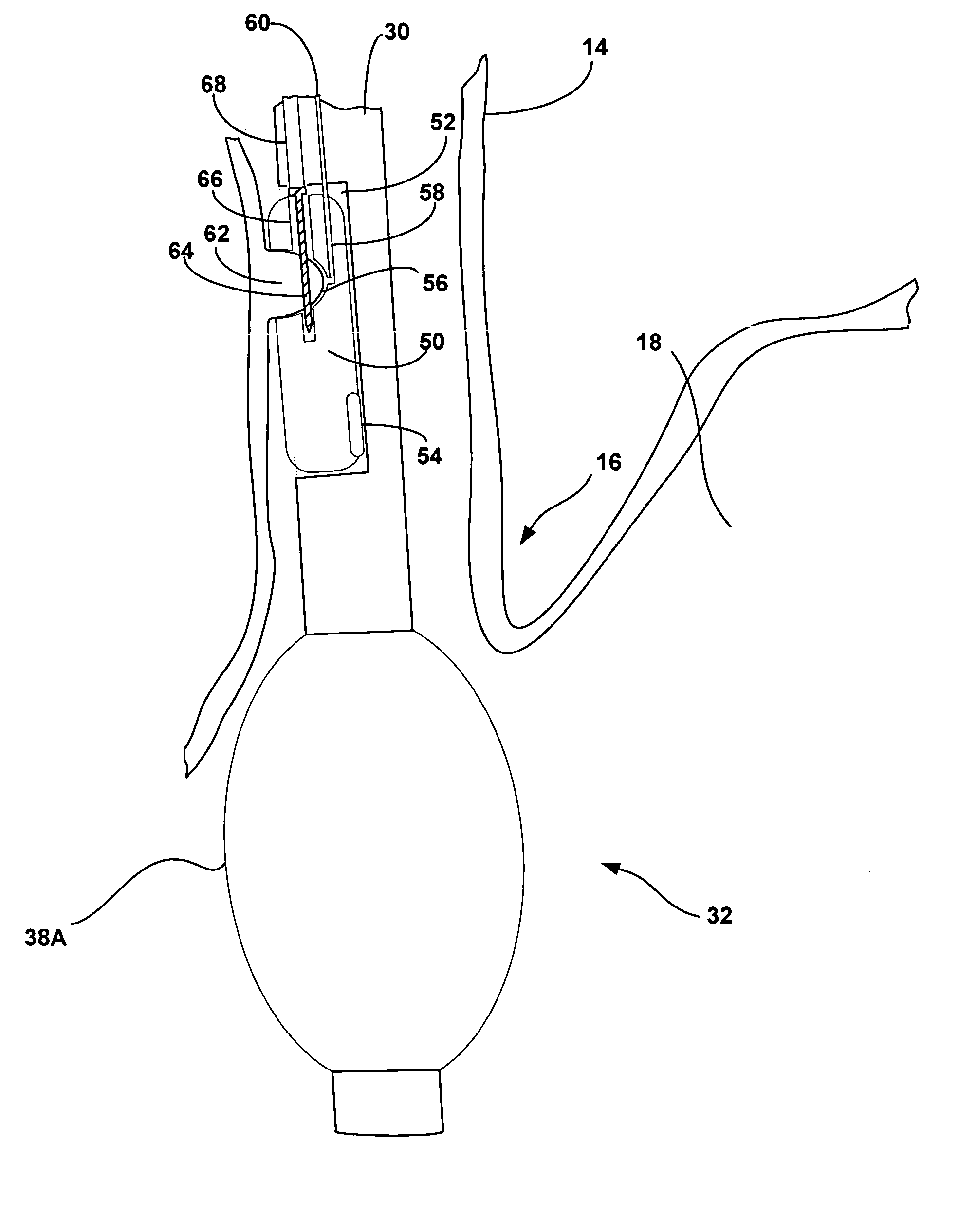 Esophageal delivery system and method with position indexing