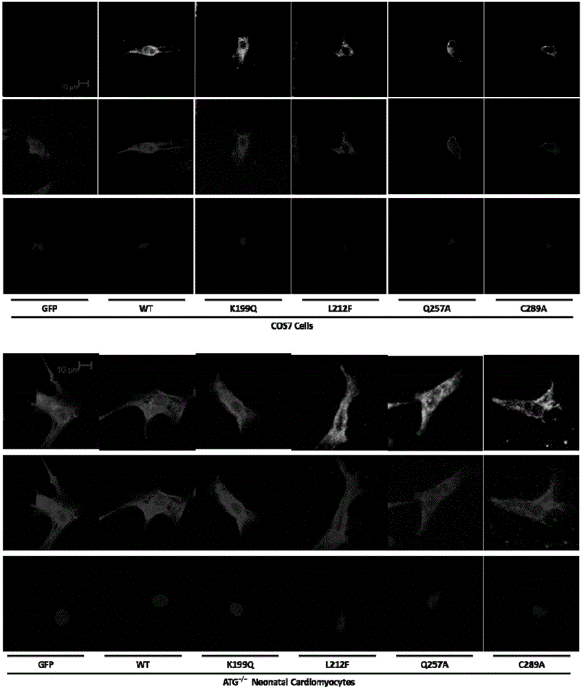 Application of angiotensin II-1 type mechanical stress receptor perception site in preparing of medicines for treating hypertension