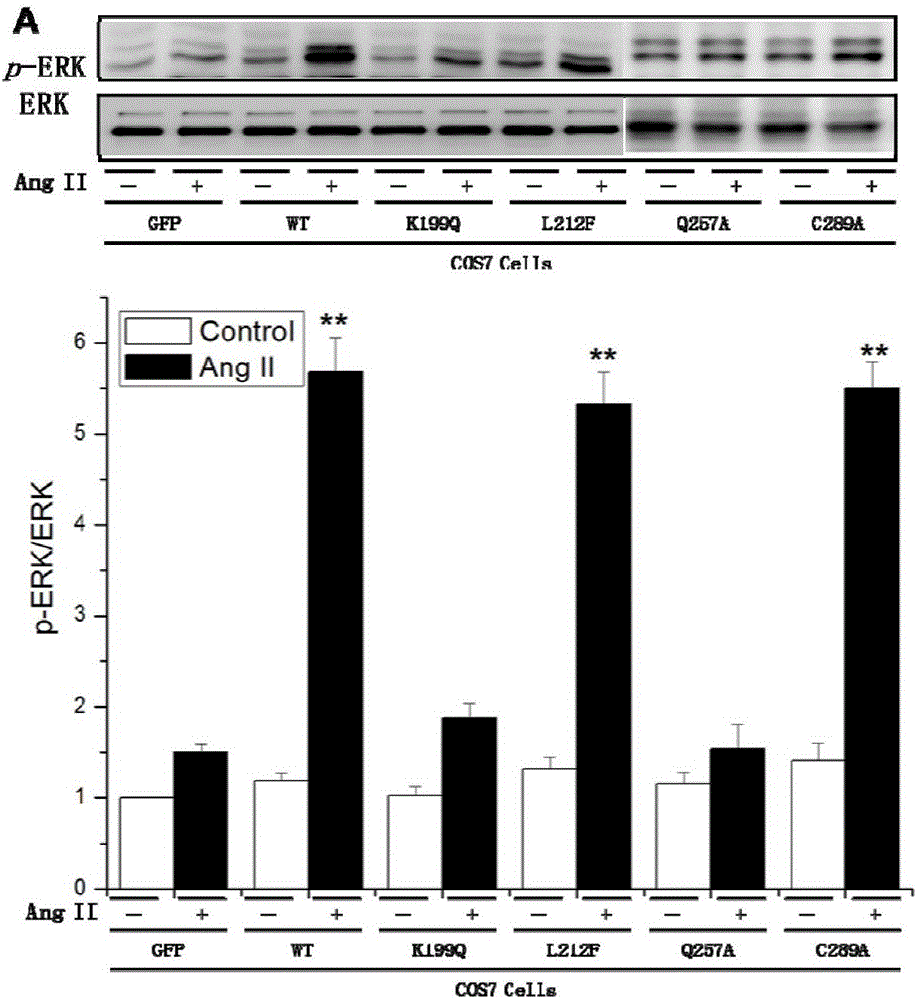 Application of angiotensin II-1 type mechanical stress receptor perception site in preparing of medicines for treating hypertension