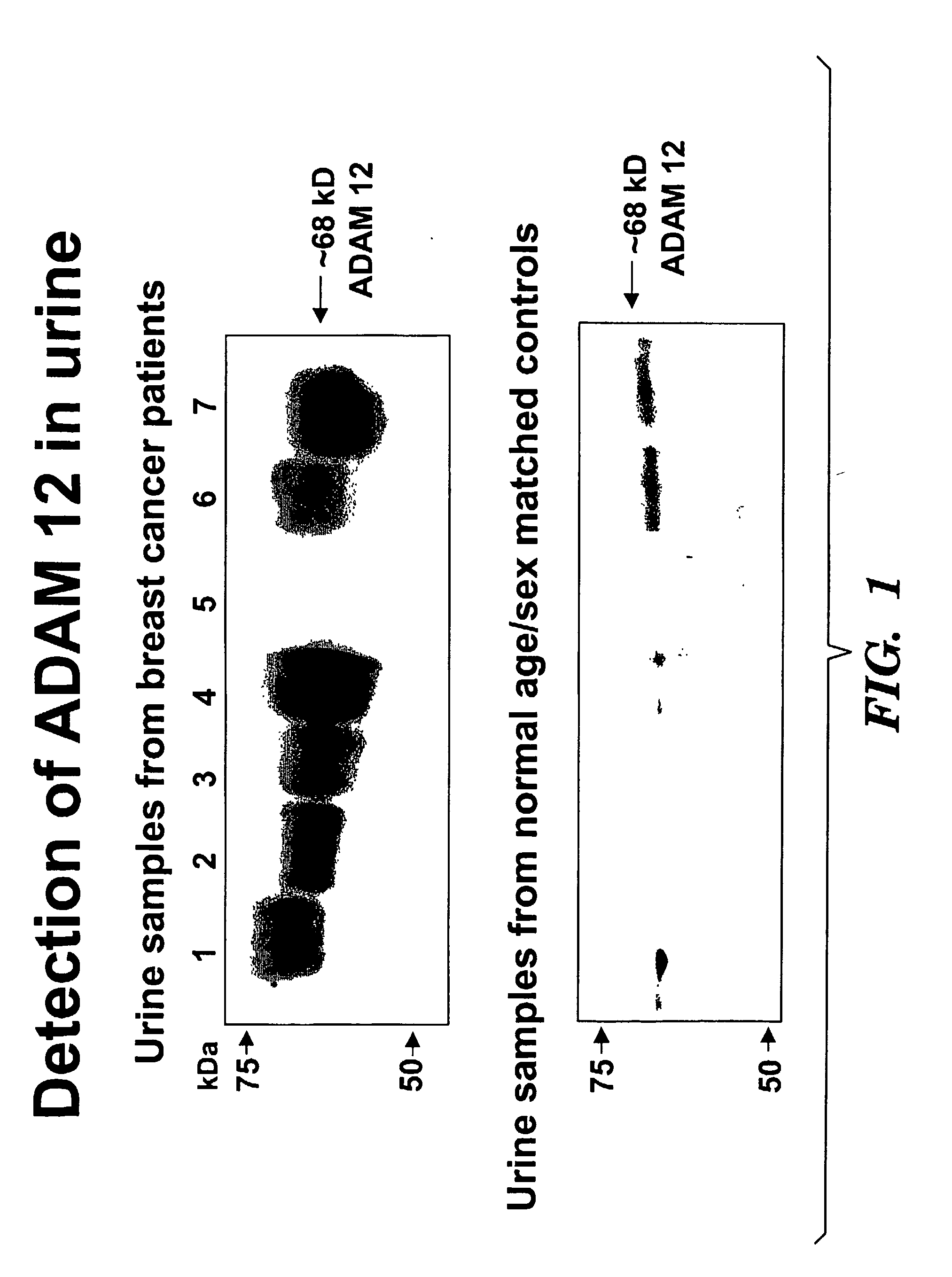 Methods for diagnosis and prognosis of cancers of epithelial origin