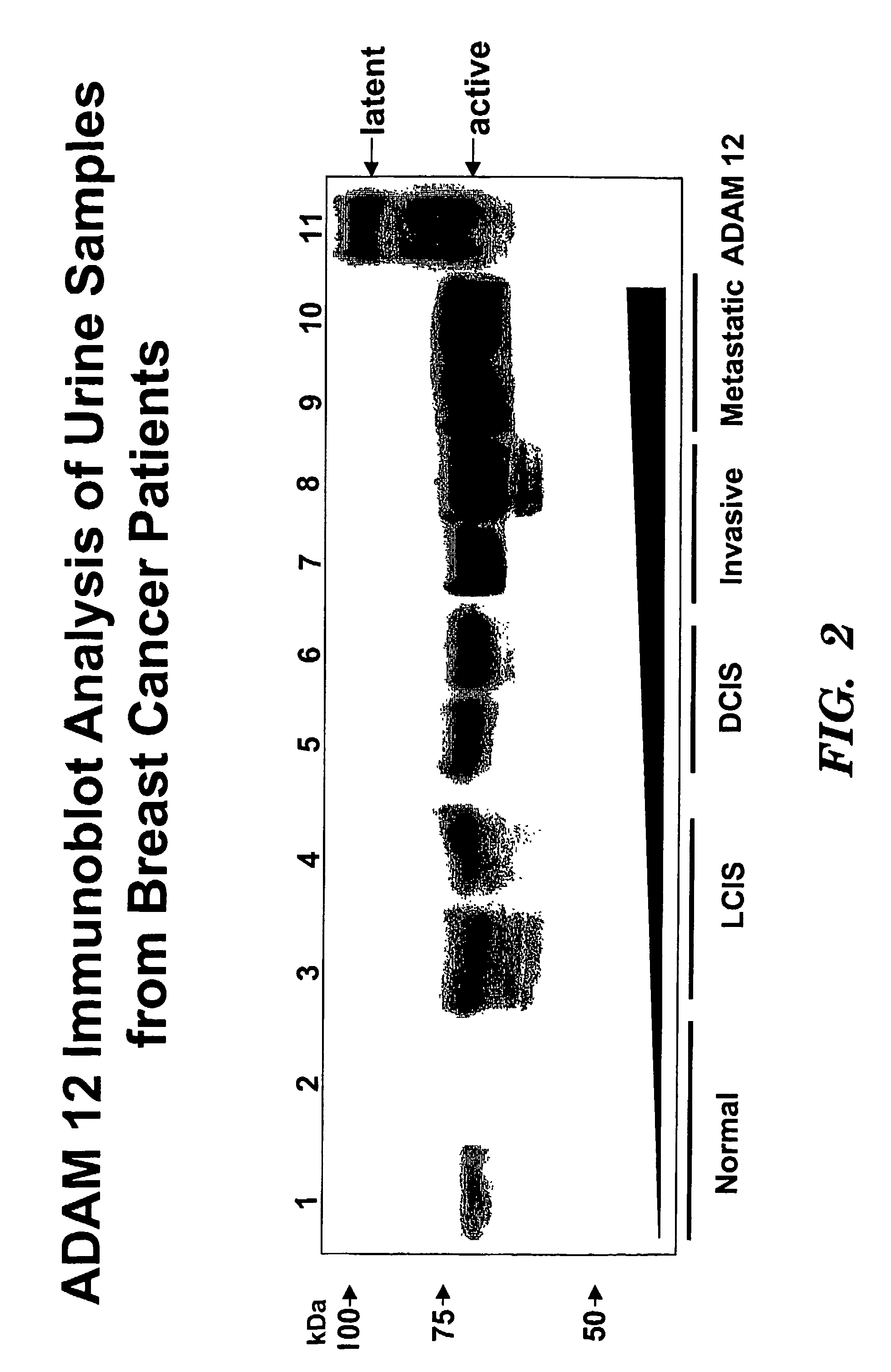 Methods for diagnosis and prognosis of cancers of epithelial origin