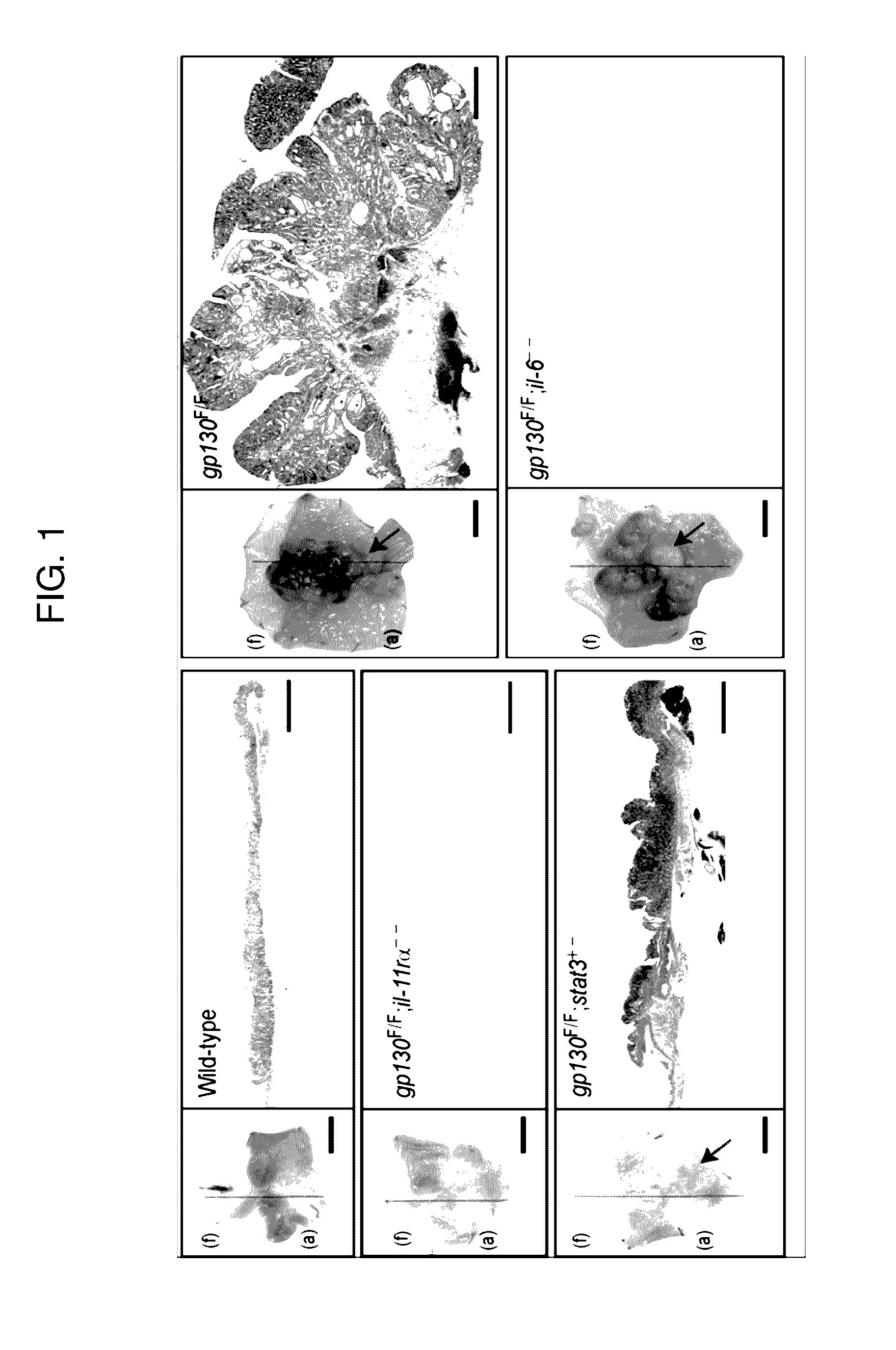 Biomarkers for gastric cancer and uses thereof