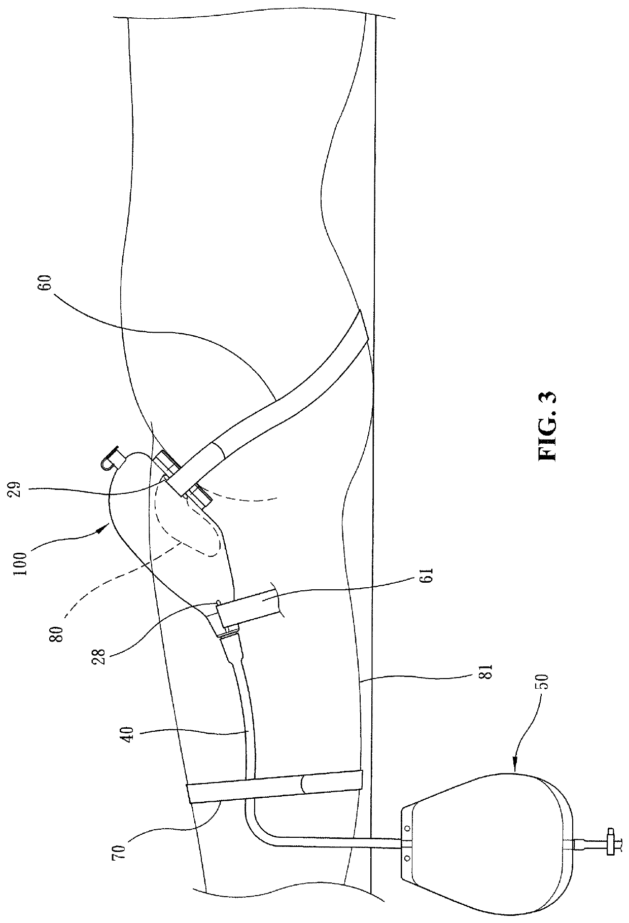Contact piece and urine discharge device