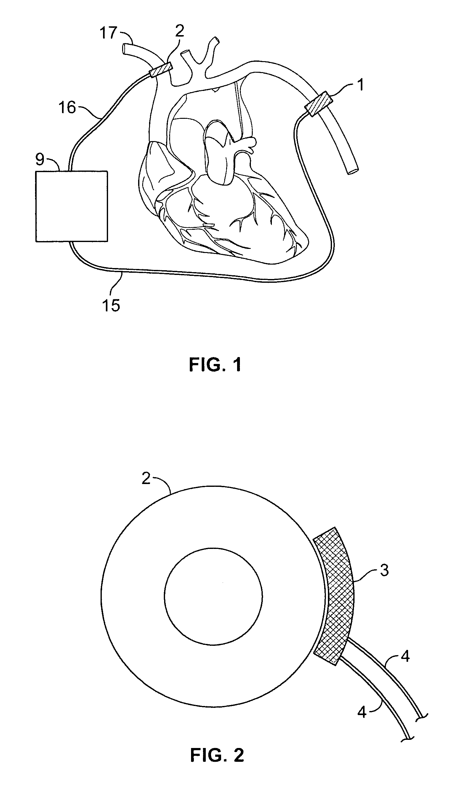 Method and device for counteracting hypotension