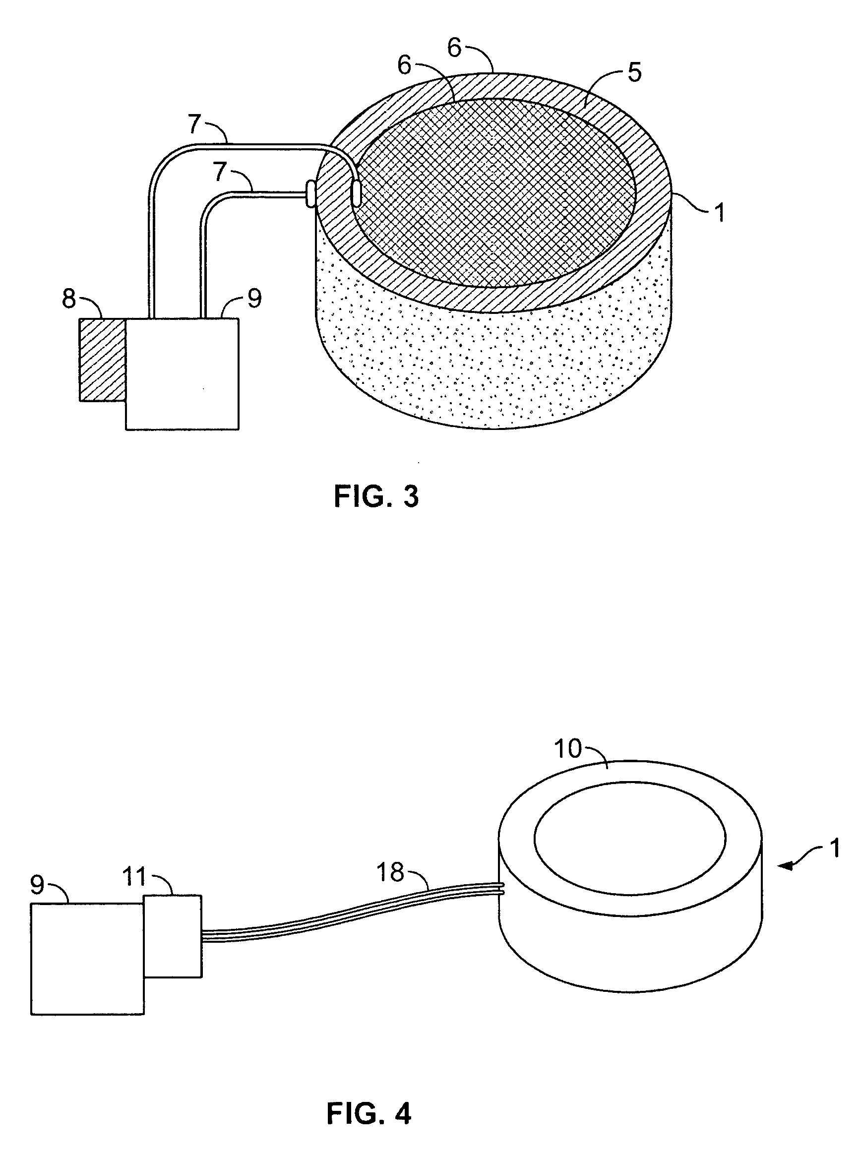 Method and device for counteracting hypotension