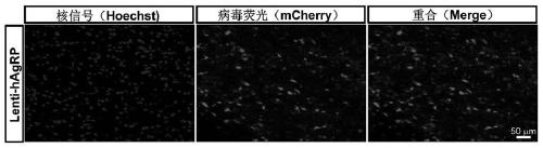 Construction method of gene overexpression chimeric animal model based on hNPY and hAgRP and application