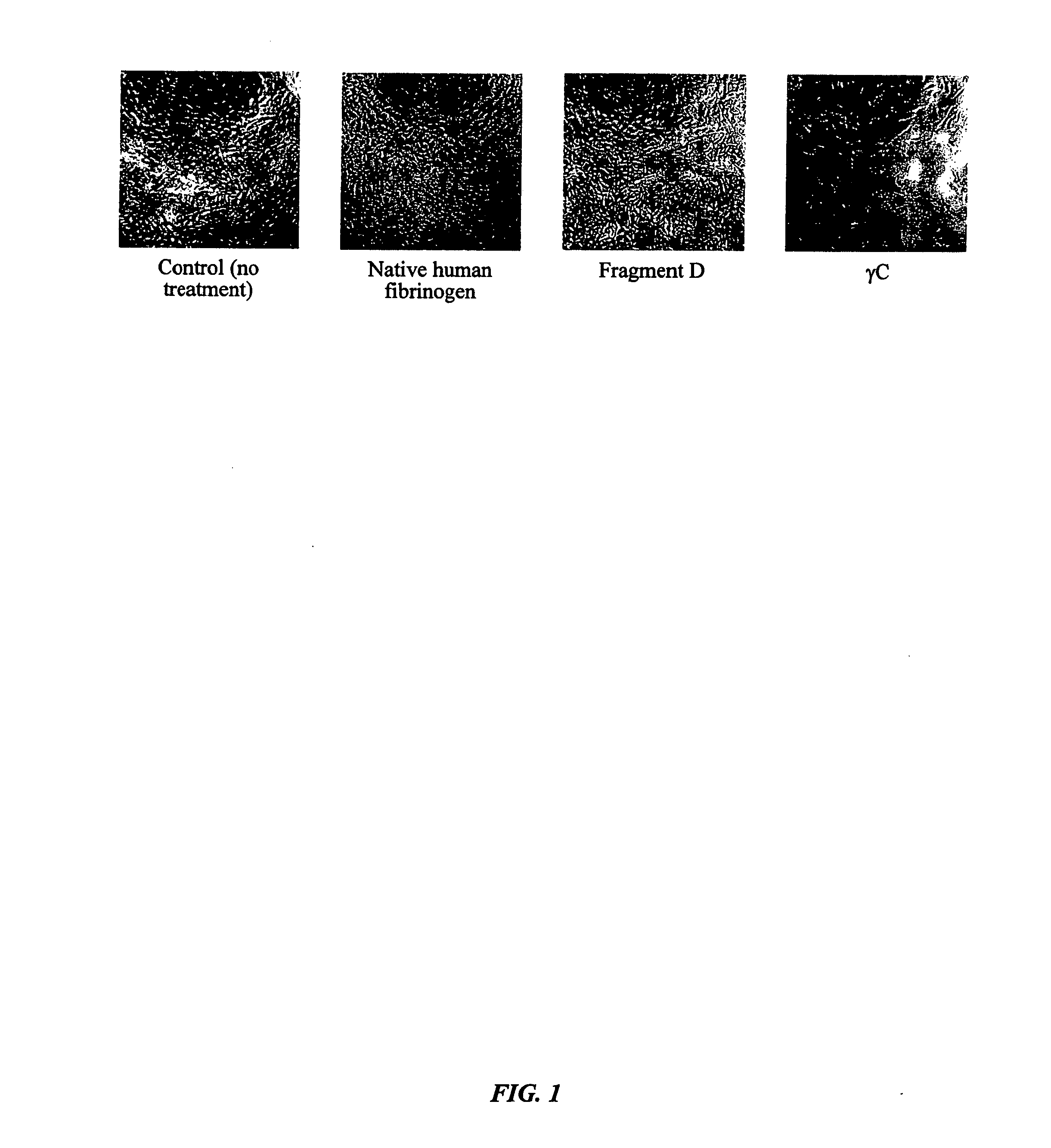 Endothelial cell apoptosis induced by fibrinogen gamma chain C-terminal fragment