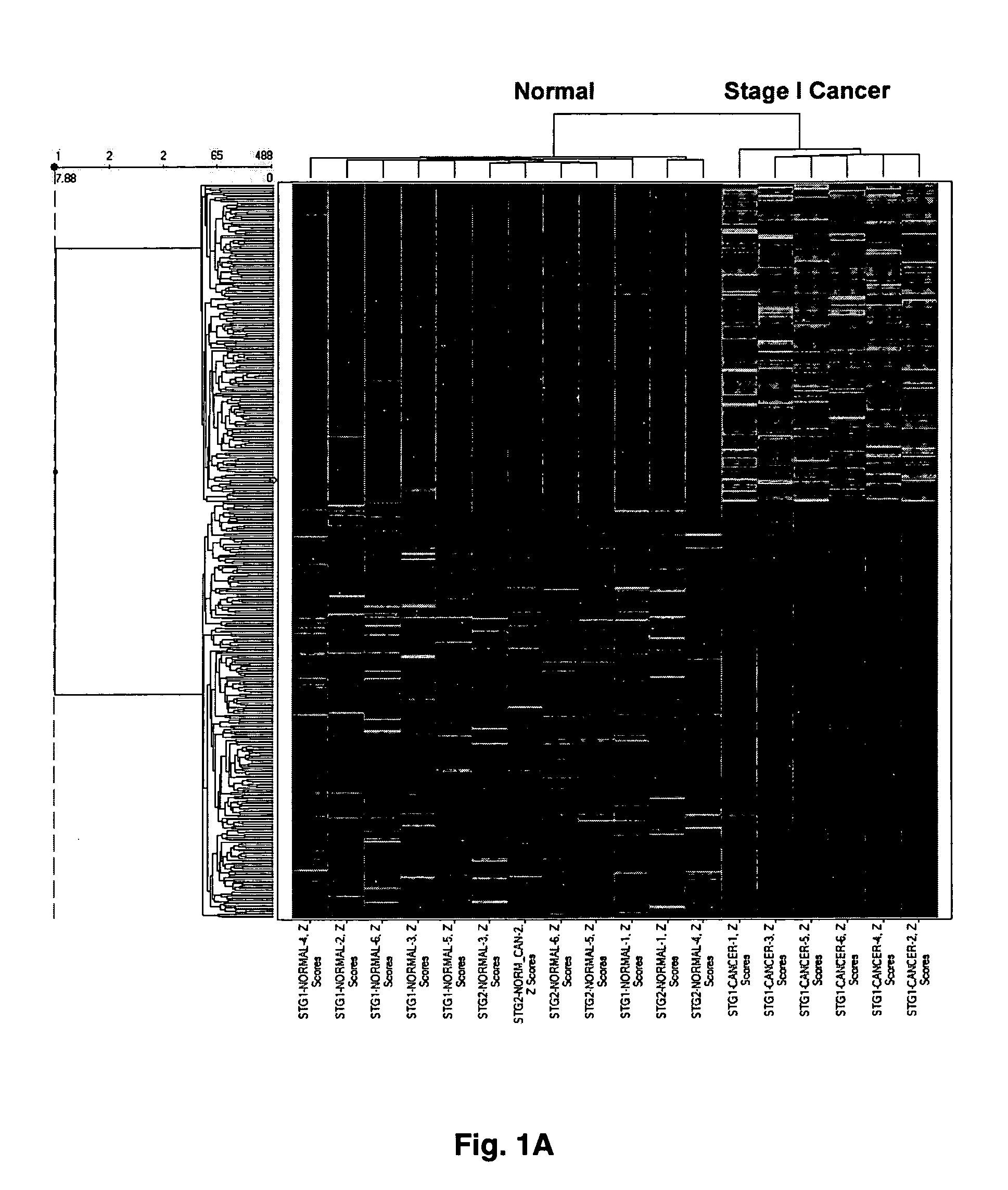Methods for detecting, diagnosing and treating human renal cell carcinoma