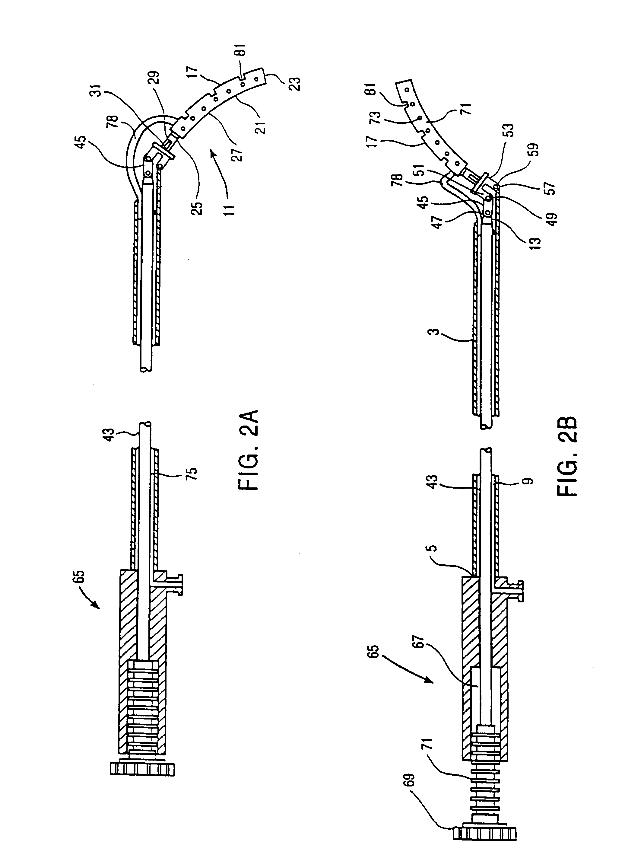 Device and method for isolating a surgical site