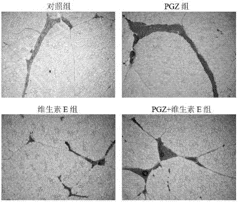 Application of pioglitazone hydrochloride and vitamin E in pig fattening feed additives