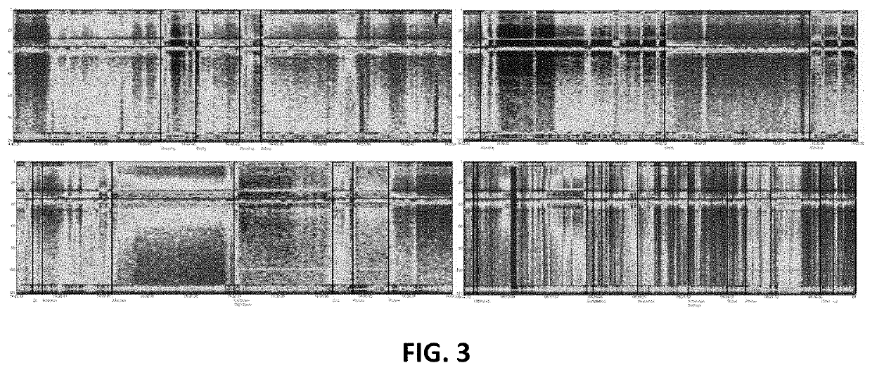 Systems and Methods for Cooperative Invasive and Noninvasive Brain Stimulation