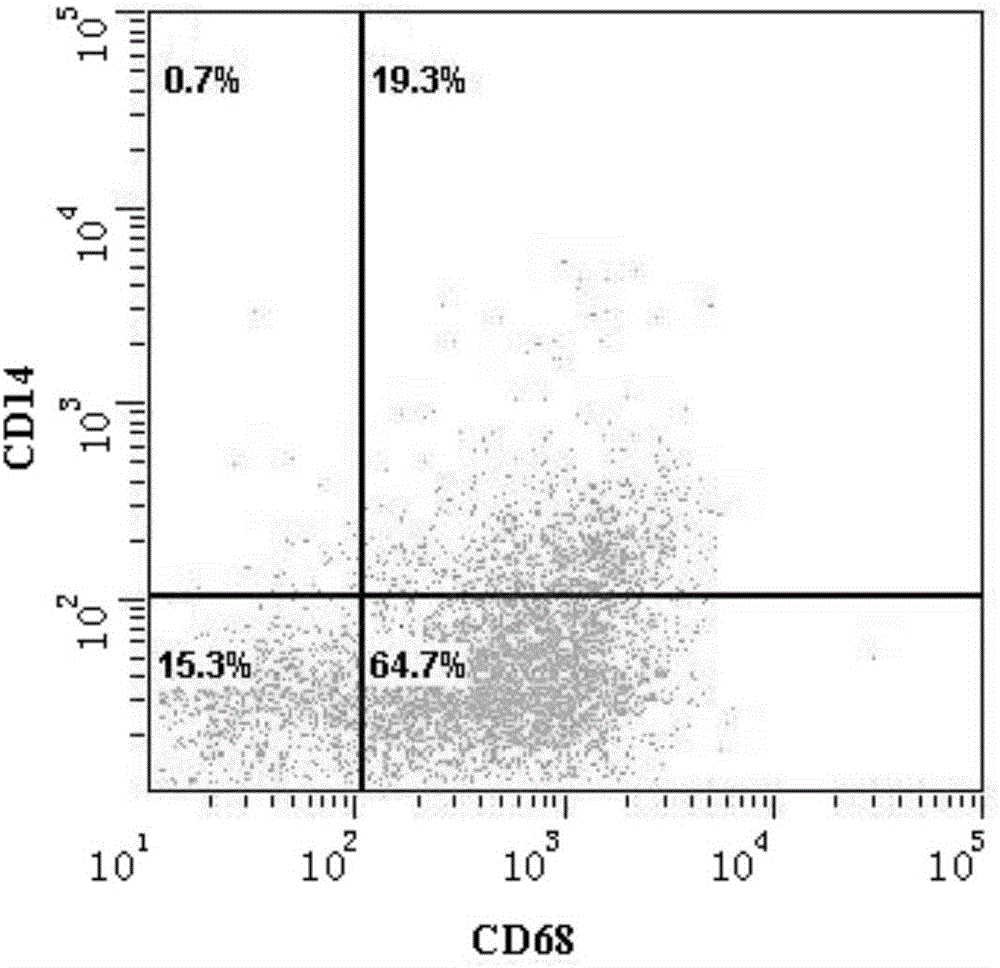 Preparation method of M1 macrophage-tumor vaccine