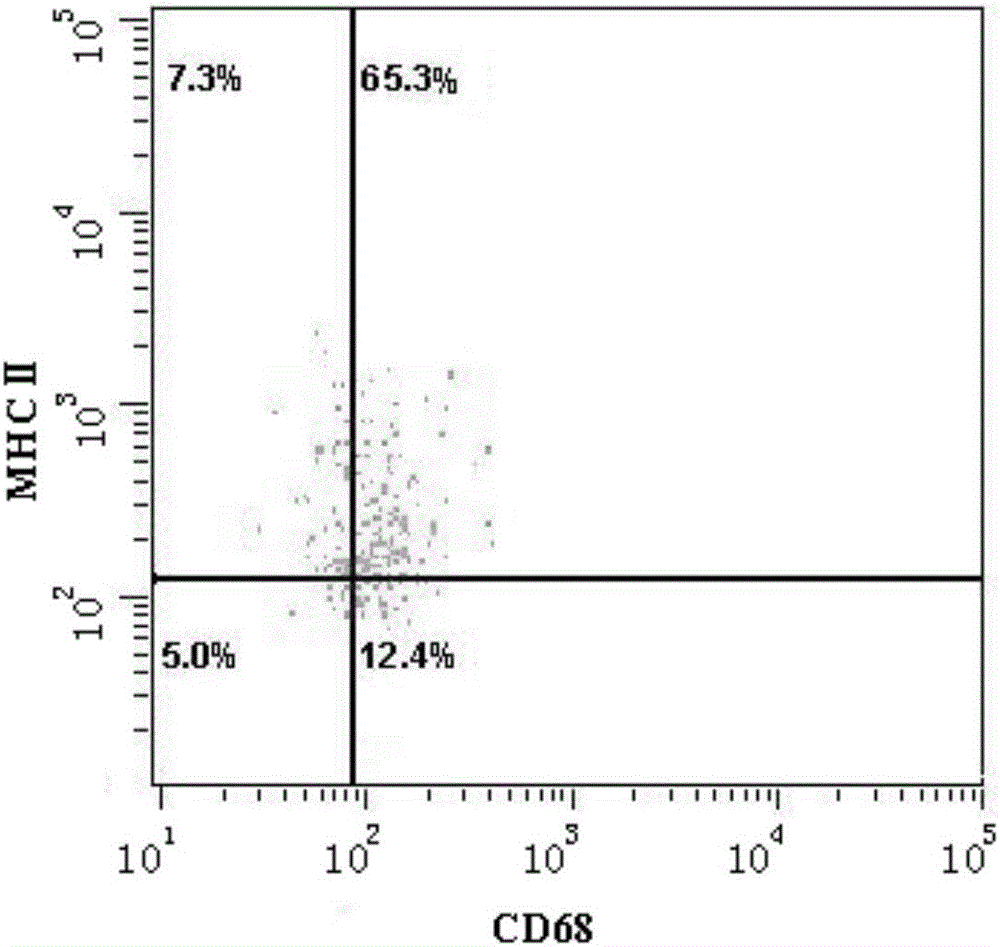 Preparation method of M1 macrophage-tumor vaccine