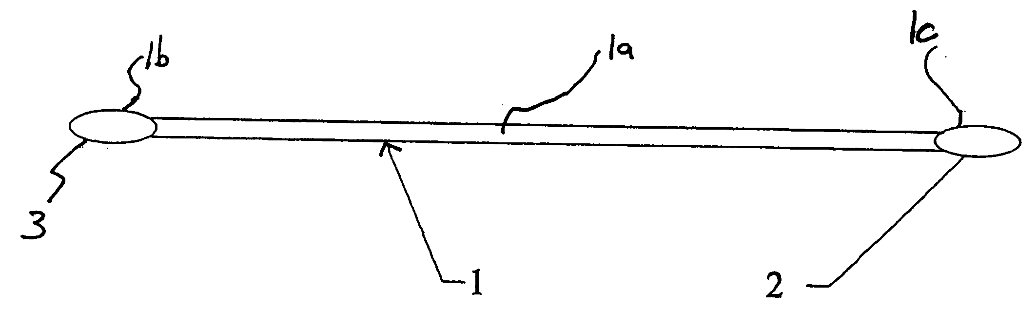 Method of stripping diseased blood vessels from the human body