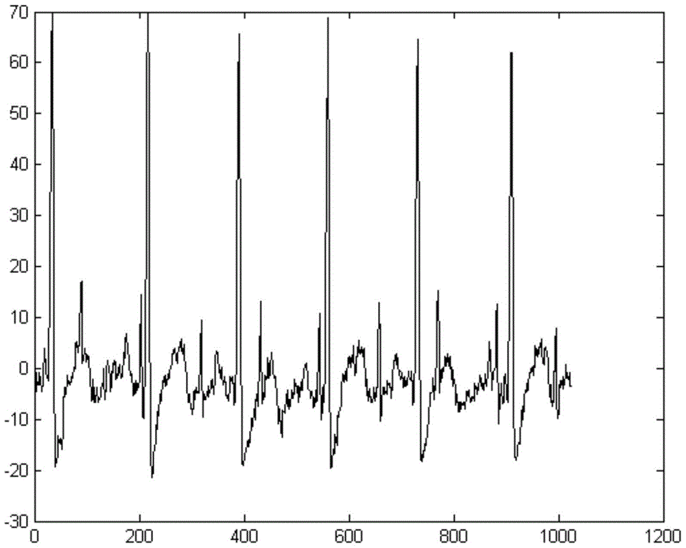 A method and system for instantaneous heart rate recognition based on non-negative blind separation of fetal ECG