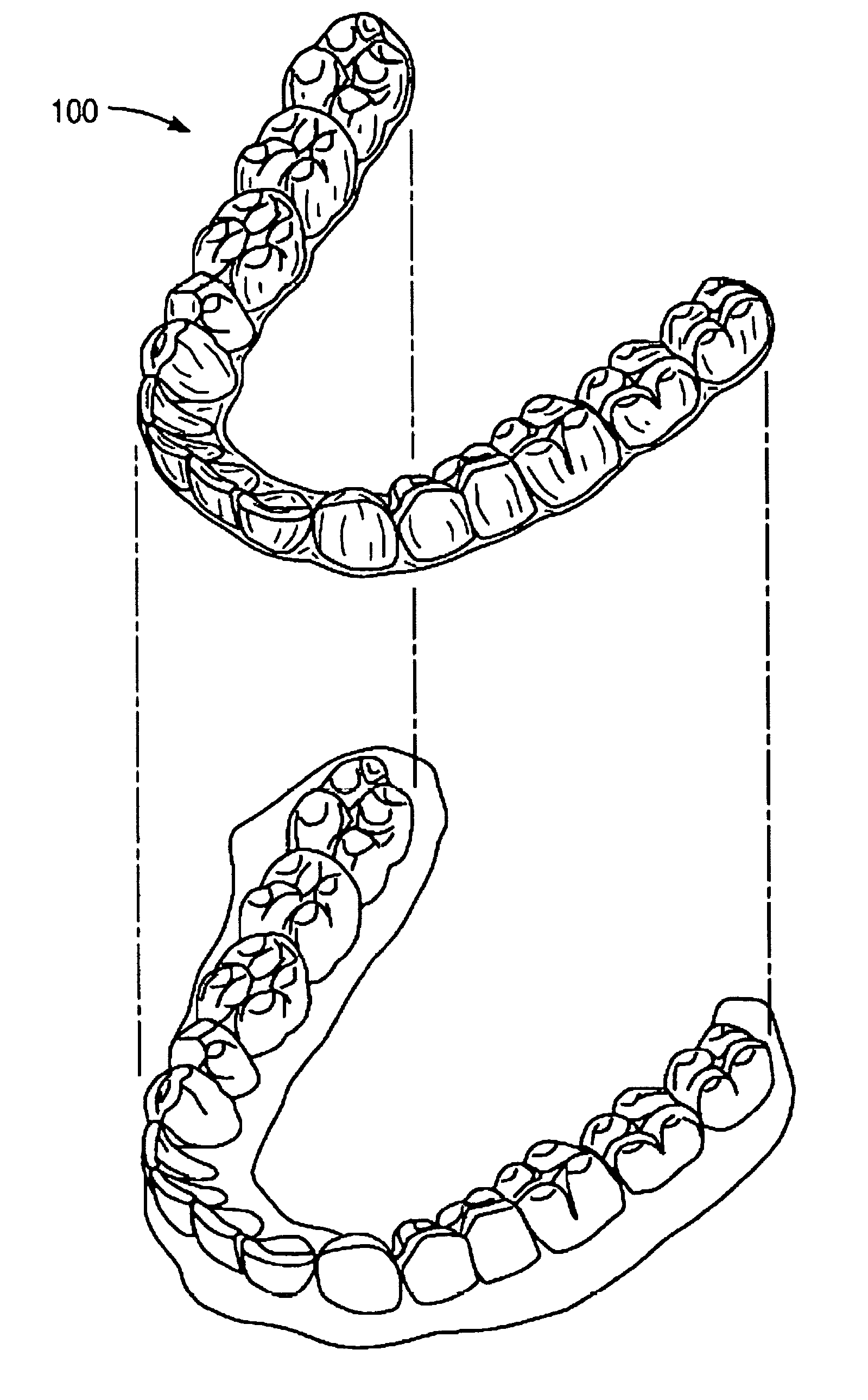 Methods and systems for lubricating dental appliances